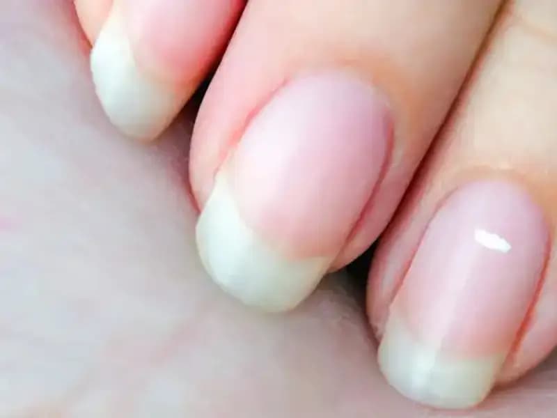 Tırnaklarınız Geleceğinizi Mi Anlatıyor? Uzmanlar Yanıtlıyor