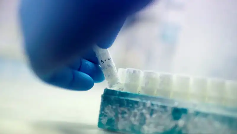Tıbbi Skandal: 85 Sperm Donörü 10.000'den Fazla Çocuğun Babası mı?
