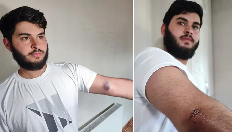 Bahçeye Kaçan Top, Mahallede Kamyonetli Kaos Başlattı!